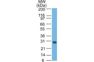 Western Blot Analysis of Jurkat cell lysate Bcl-x Mouse Monoclonal Antibody (BX006). (BCL2L1 antibody  (AA 3-14))