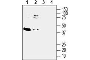 Western blot analysis of rat (lanes 1 and 3) and mouse (lanes 2 and 4) brain lysates: - 1,2. (Mesothelin antibody  (Extracellular))