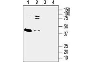 Western blot analysis of rat (lanes 1 and 3) and mouse (lanes 2 and 4) brain lysates: - 1,2. (GPER antibody  (3rd Extracellular Loop))