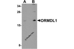 Western Blotting (WB) image for anti-ORM1-Like 1 (ORMDL1) antibody (ABIN1031784) (ORMDL1 antibody)