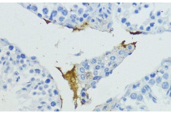 KLKB1 antibody