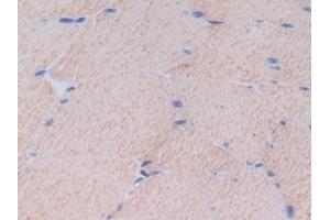 Immunohistochemistry (IHC) image for anti-Fibronectin (AA 355-558) antibody (ABIN7429001)