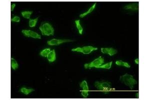 Immunofluorescence (IF) image for anti-Acid Phosphatase 2, Lysosomal (ACP2) antibody (ABIN781949)
