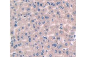 Figure. (IL-1 beta antibody  (AA 118-269))