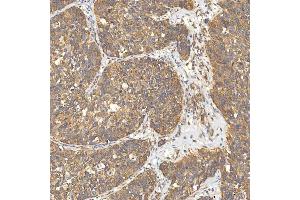 IHC analysis of Citrin/SLC25A13 using anti-Citrin/SLC25A13 antibody (ABIN7599512). (slc25a13 antibody  (AA 1-643))