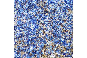 Immunohistochemistry of paraffin-embedded Mouse spleen using GMIP Rabbit pAb (ABIN7267369) at dilution of 1:100 (40x lens). (GMIP antibody  (AA 1-91))