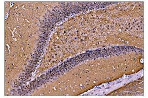 IHC analysis of CAMKIV/Camk4 using anti-CAMKIV/Camk4 antibody (ABIN7600419). (CAMK4 antibody  (AA 19-469))