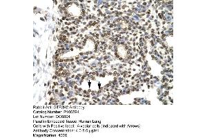 Human Lung (GTF2H2 antibody  (C-Term))