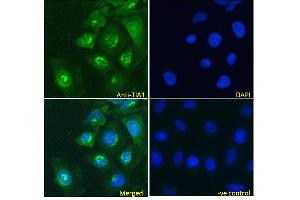 ABIN190808 Immunofluorescence analysis of paraformaldehyde fixed HeLa cells, permeabilized with 0. (TIA1 antibody  (Internal Region))