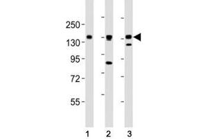 AXL antibody at 1:2000 dilution. (AXL antibody  (AA 838-872))