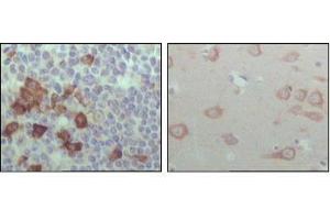 Immunohistochemical analysis of paraffin-embedded human lymph node (left) and brain (right), showing cytoplasmic localization with DAB staining using EhpB6 antibody. (EPH Receptor B6 antibody  (AA 601-750))