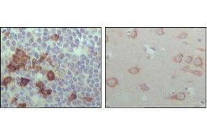 Immunohistochemical analysis of paraffin-embedded human lymph node (left) and brain (right), showing cytoplasmic localization with DAB staining using EhpB6 antibody.