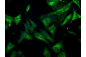 Image no. 6 for anti-Budding Uninhibited By Benzimidazoles 1 Homolog beta (Yeast) (BUB1B) antibody (ABIN1496996) (BUB1B antibody)