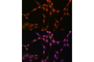 Immunofluorescence analysis of NIH-3T3 cells using Glutathione Synthetase (GSS) (GSS) Rabbit mAb (ABIN7267452) at dilution of 1:100 (40x lens). (Glutathione Synthetase antibody)