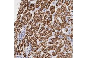 Immunohistochemical staining of human liver with OTC polyclonal antibody  shows cytoplasmic positivity in hepatocytes. (OTC antibody  (AA 172-299))