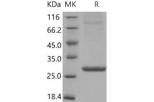 Amyloid P Component, Serum (APCS) (Active) protein (His tag)