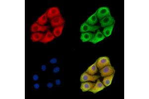 ABIN7095806 and ABIN7099868 staining Hela cells by IF/ICC. (SMOC2 antibody)