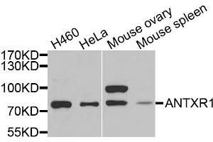 Western blot analysis of extracts of various cell lines, using ANTXR1 antibody (ABIN5973910) at 1/1000 dilution.