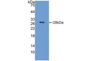 Detection of Recombinant NCL, Mouse using Polyclonal Antibody to Nucleolin (NCL)