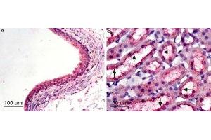 Expression of AQP7 in rat kidney - Immunohistochemical staining of paraffin-embedded rat kidney sections using Anti-Aquaporin 7 Antibody (ABIN7042943, ABIN7045203 and ABIN7045204), (1:100). (Aquaporin 7 antibody  (Intracellular, N-Term))