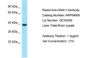 Western Blotting (WB) image for anti-Guanine Nucleotide Binding Protein (G Protein), alpha 11 (Gq Class) (GNA11) (C-Term) antibody (ABIN2790005)
