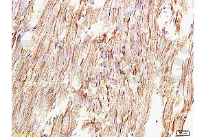 Formalin-fixed and paraffin embedded rat myocardium tissue labeled with Anti-AT1R/AGTR1 Polyclonal Antibody, Unconjugated (ABIN671121) at 1:200, followed by conjugation to the secondary antibody and DAB staining (Angiotensin II Type-1 Receptor antibody)