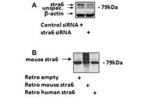 Image no. 1 for anti-Stimulated By Retinoic Acid 6 (STRA6) (C-Term) antibody (ABIN374801) (STRA6 antibody  (C-Term))