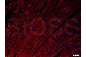 Formalin-fixed and paraffin embedded rat heart tissue labeled with Anti- Connexin-37/GJA4 Polyclonal Antibody, Unconjugated  at 1:200 followed by conjugation to the secondary antibody Goat Anti-Rabbit IgG, PE conjugated -PE) used at 1:200 dilution for 40 minutes at 37°C and DAPI. (GJA4 antibody  (AA 151-250))