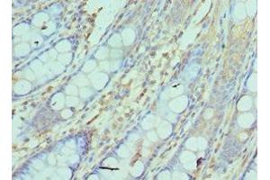 Immunohistochemistry of paraffin-embedded human colon tissue using ABIN7161752 at dilution of 1:100 (NCBP2 antibody  (AA 1-156))