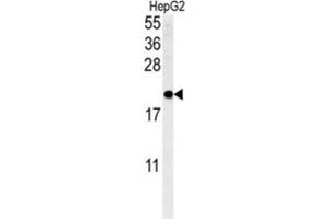 Western Blotting (WB) image for anti-SFT2 Domain Containing 3 (SFT2D3) antibody (ABIN3002289)