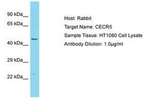 Image no. 1 for anti-Cat Eye Syndrome Chromosome Region, Candidate 5 (CECR5) (AA 353-402) antibody (ABIN6750600) (CECR5 antibody  (AA 353-402))