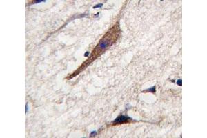 IHC analysis of FFPE human brain tissue stained with PAK5 antibody (PAK7 antibody  (AA 168-198))