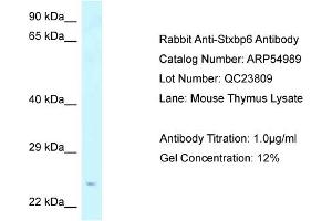 Western Blotting (WB) image for anti-Syntaxin Binding Protein 6 (Amisyn) (STXBP6) (N-Term) antibody (ABIN2785992)