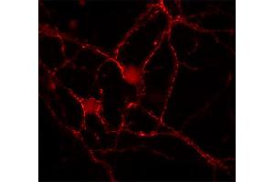 Indirect immunostaining of rat hippocampus neurons (dilution 1 : 100). (Doc 2a/b antibody)
