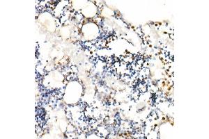 Immunohistochemistry (IHC) image for anti-Elastase, Neutrophil Expressed (ELANE) (AA 30-267) antibody (ABIN6140110)
