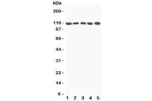 Western blot testing of C5a antibody and Lane 1:  rat liver;  2: mouse liver;  3: (m) NIH3T3;  4: (m) HEPA;  5: (r) PC12 lysate;  Predicted/Observed size: 115KD (C5A antibody  (N-Term))