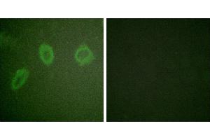 Peptide - +Immunofluorescence analysis of HuvEc cells, using ErbB2 antibody. (ErbB2/Her2 antibody  (Internal Region))