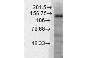 Western Blot analysis of Rat brain membrane lysate showing detection of Slo2. (KCNT1 antibody  (AA 1168-1237) (Biotin))