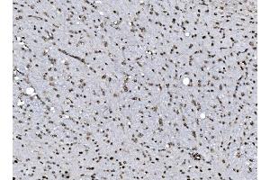 IHC analysis of DBC-1/CCAR2 using anti-DBC-1/CCAR2 antibody (ABIN7602235). (CCAR2 antibody  (AA 65-917))