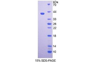 SDS-PAGE (SDS) image for Paired Box 9 (PAX9) (AA 1-341) protein (His tag) (ABIN6237210) (PAX9 Protein (AA 1-341) (His tag))