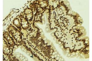 ABIN6277777 at 1/100 staining Mouse colon tissue by IHC-P. (LEF1 antibody  (Internal Region))