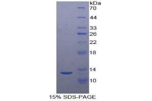 SDS-PAGE analysis of Human Urotensin 2 Protein. (Urotensin 2 Protein (UTS2))