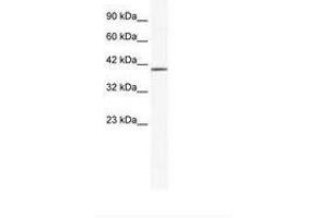 Image no. 1 for anti-Zinc Finger Protein 322A (ZNF322A) (AA 63-112) antibody (ABIN6735994)