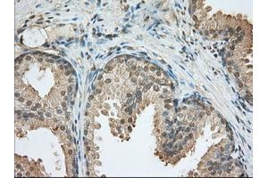 Immunohistochemical staining of paraffin-embedded Human liver tissue using anti-PDE4A mouse monoclonal antibody.