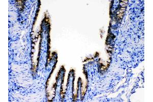 IHC analysis of AGRP using anti-AGRP antibody . (AGRP antibody  (AA 82-131))