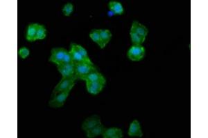 Immunofluorescence staining of HepG2 cells with ABIN7168260 at 1:133, counter-stained with DAPI. (RNF39 antibody  (AA 200-321))