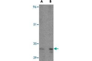 Western blot analysis of ATG5 in rat spleen tissue lysate with ATG5 polyclonal antibody  at (A) 1 and (B) 2 ug/mL . (ATG5 antibody  (N-Term))