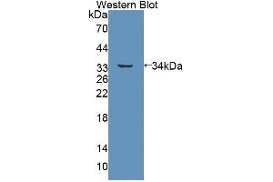 Figure. (ABCB7 antibody  (AA 472-752))