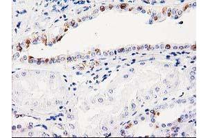 Immunohistochemical staining of paraffin-embedded Human Kidney tissue using anti-ITM2B mouse monoclonal antibody. (ITM2B antibody)