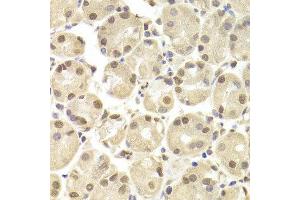 Immunohistochemistry of paraffin-embedded Human gastric using POU2F1 antibody at dilution of 1:100 (x400 lens). (POU2F1 antibody  (AA 15-290))